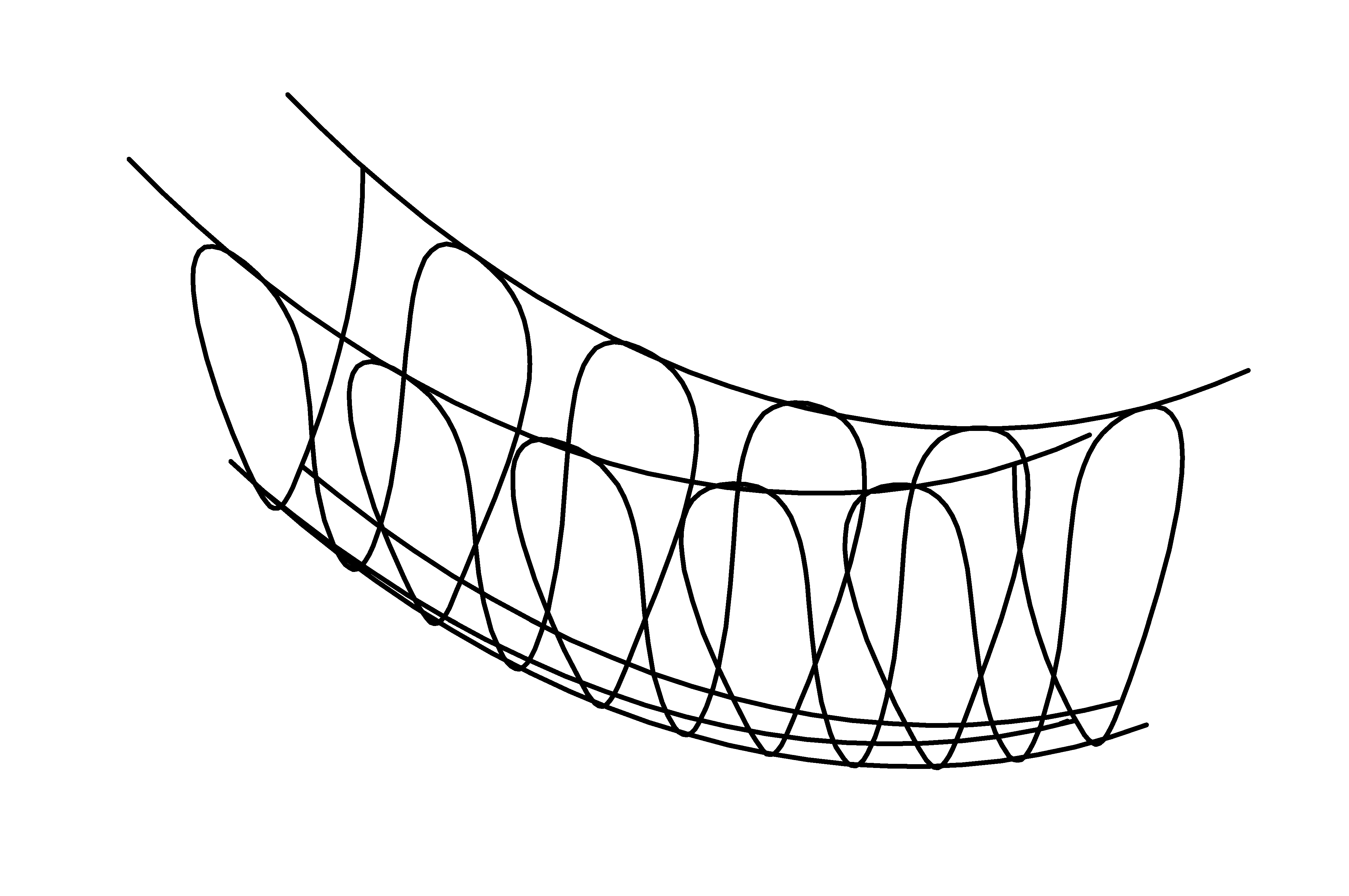 Rope Bridge, red, length = 2 m